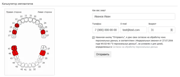 калькулятор имплантатов на битриксе калькулятор имплантатов для битрикс
